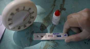 Covid-19: pesquisa testará presença de anticorpos em 211 mil pessoas